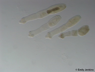 Echinococcus adults